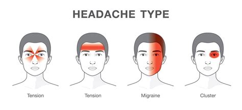 Headache Treatment and Migraine Cures Guide - Learn The Facts