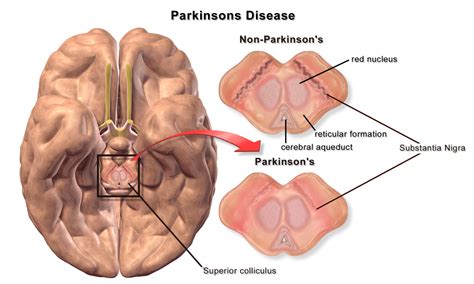 Subthalamus | Facts, Anatomy, Function, Position & Summary