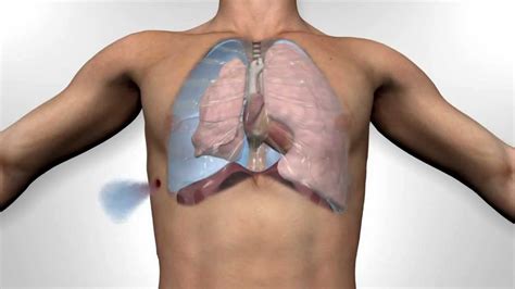 Russell Chest Seal Open Pneumothorax - YouTube