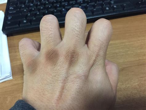 Why are my knuckles dark? : r/pics