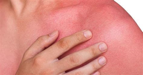 Skin redness: Causes and when to see a doctor