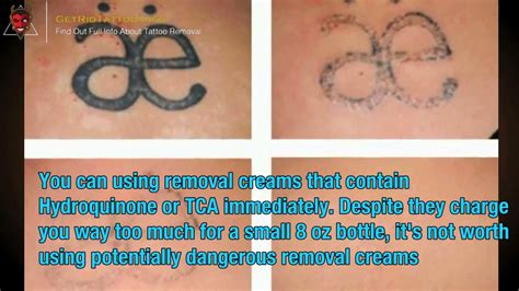 Tattoo Cream Removal Reviews : TatEraser™ Tattoo Removal Cream ...