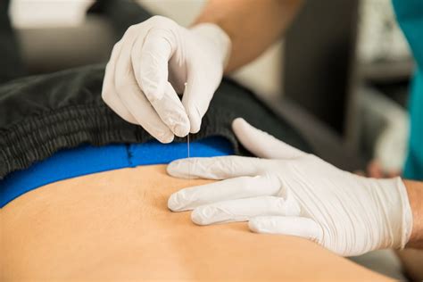 Dry Needling for Pain Relief: A New Tool for Your Pain Toolkit - Life ...