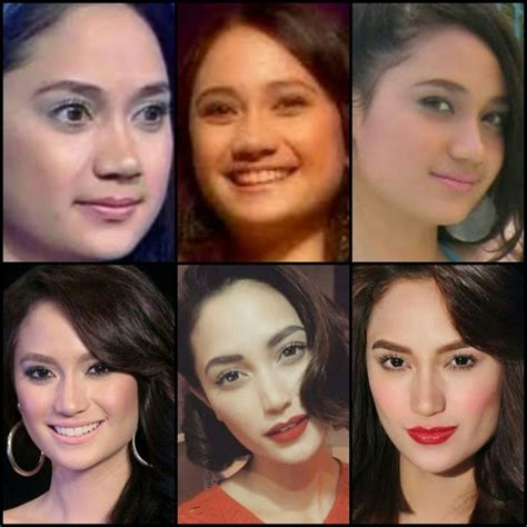 Arci Munoz | Arci munoz, Surgery, Bad