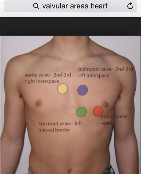 Placement for abnormal heart sounds Nursing School Studying, Nursing ...