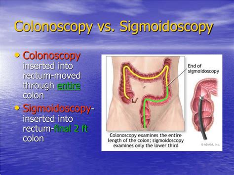 PPT - What is a colonoscopy? PowerPoint Presentation, free download ...