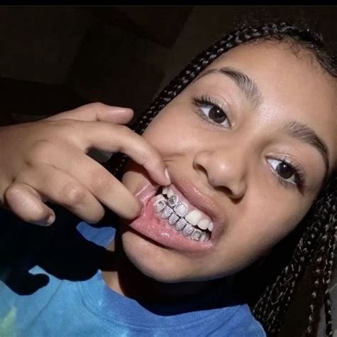 miss miss westie ⭐️ in 2024 | Grillz, Kanye west, Grills teeth