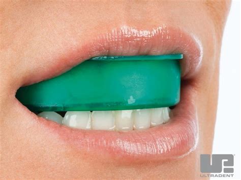 Opalescence GO 15% MINT Whitening Trays - Smiles By Natasha