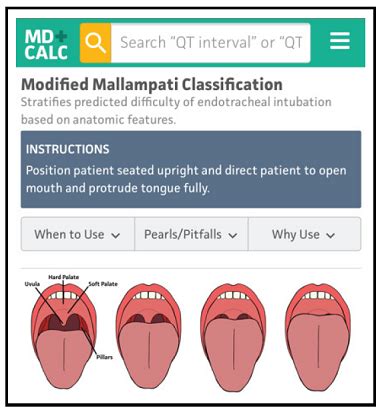 Supraglottic Airway Devices for Pediatric Airway Management in the ...