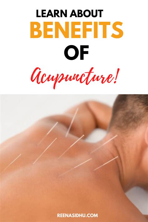 The Many Benefits Of Acupuncture | Acupuncture, Health quotes, Holistic ...