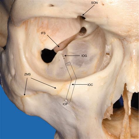 Infraorbital Region | SpringerLink