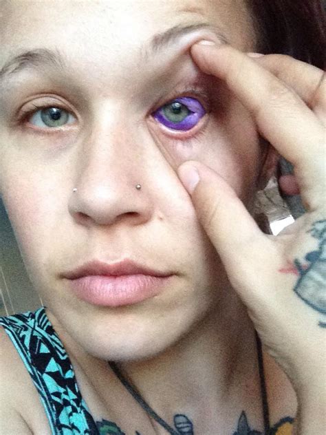 Canadian woman could go blind after getting eyeball tattooed (PHOTOS ...