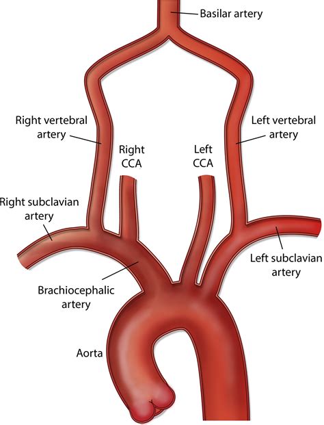 Pathophysiology Arteries Anatomy Carotid Artery Vertebral Artery ...