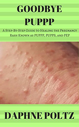 Goodbye PUPPP: A Step-by-Step Guide to Healing the Pregnancy Rash Known ...