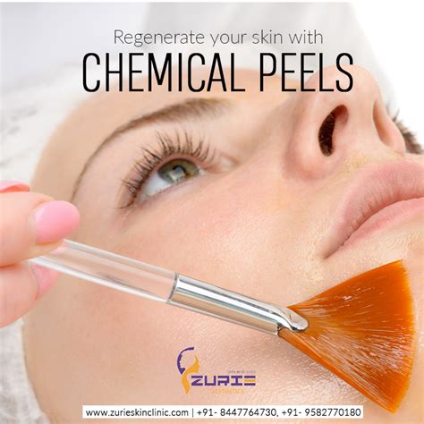 Chemical Peel is a popular and effective aesthetic procedure that can ...