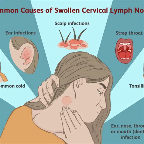 How To Drain Lymph Node Under Chin - Best Drain Photos Primagem.Org