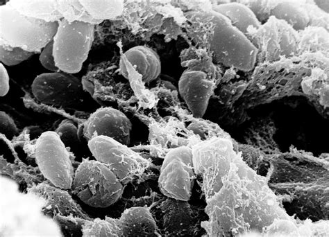 File:Yersinia pestis.jpg - Wikipedia