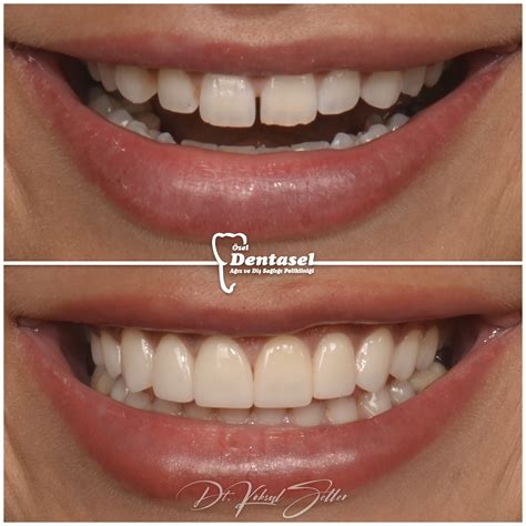 Smile Design - Özel Dentasel Ağız ve Diş Sağlığı Polikliniği