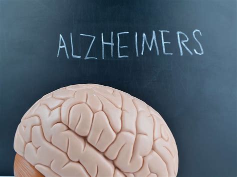 Alzheimer's Disease: What Is Alzheimer's Disease?