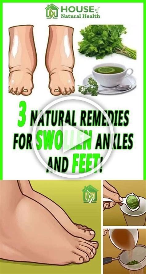 Easy 12 Home Remedies of How to Reduce Swollen feet - Natural Cure for ...