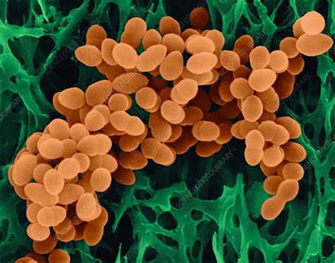 Staphylococcus aureus, SEM - Stock Image - C032/2550 - Science Photo ...