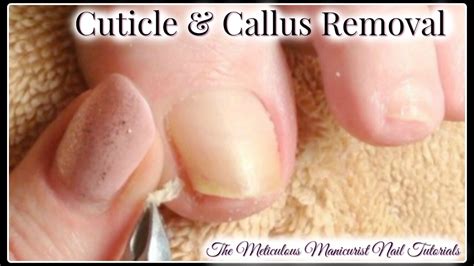 Pedicure Tutorial: Cleaning Toenail Buildup and Cuticle Removal - YouTube