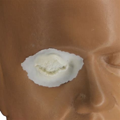 Rubber Wear Foam Latex Prosthetic Gouged Eye | Alcone Company