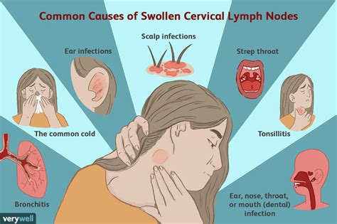 Where are your lymph nodes in your neck - rockslader