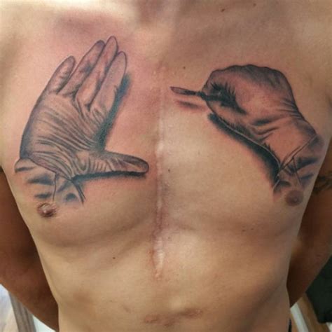 211 Amazing Tattoos That Turn Scars Into Works Of Art | Bored Panda