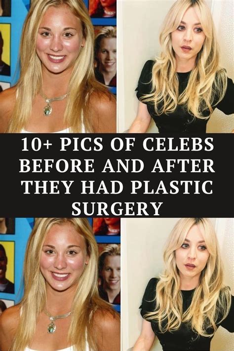 10+ Pics Of Celebs Before And After They Had Plastic Surgery in 2023 ...