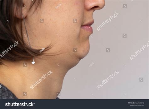 Woman Double Chin Close Side View Stock Photo 1552189646 | Shutterstock