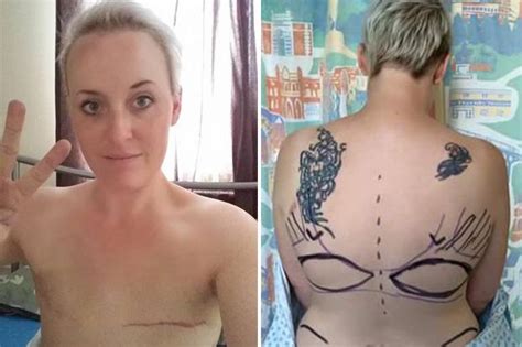 Cancer mum shows off chest after double mastectomy! | Daily Star ...