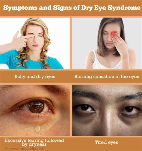 Dry Eye Syndrome Causes Symptoms Of Chronic Dry Eye