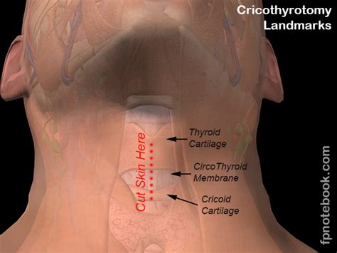 Cricothyroidotomy Anatomy