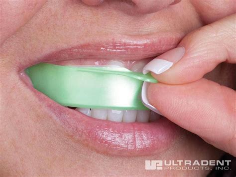 Opalescence Go 15% Mint Prefilled Teeth Whitening Trays Guaranteed ...