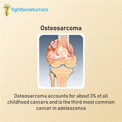 #Osteosarcoma is a type of #BoneCancer that begins in the cells that ...