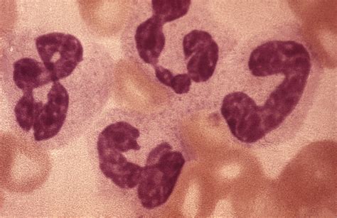 Leukocytosis | White Blood Cells, High Counts & Inflammation | Britannica