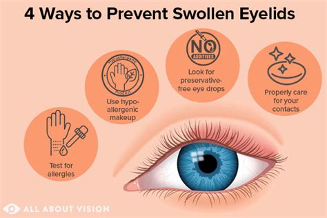 Swollen Eyelid Treatment and Prevention - All About Vision