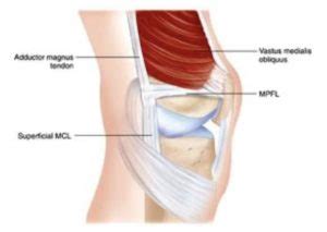 Medial Patellofemoral Ligament (MPFL) - Gorav Datta