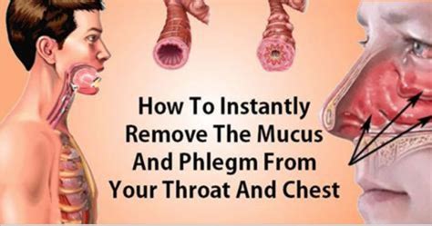 How To Eliminate Mucus And Phlegm From Your Throat And Chest (Instant ...