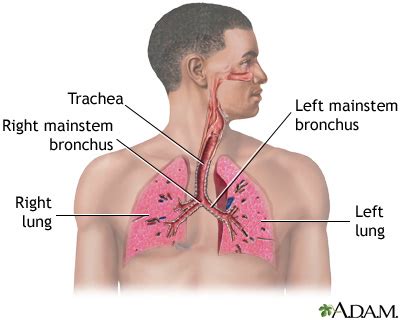 Lung Diseases: Causes and Risks - Tipik|NeT