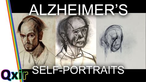 Artist With Alzheimer's Disease Draws Himself as Condition Progresses