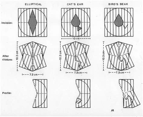 this figure shows the size and the profile of the elliptical incision ...