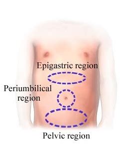 Periumbilical Pain Location, Symptoms, Causes, Treatment - Health Care ...