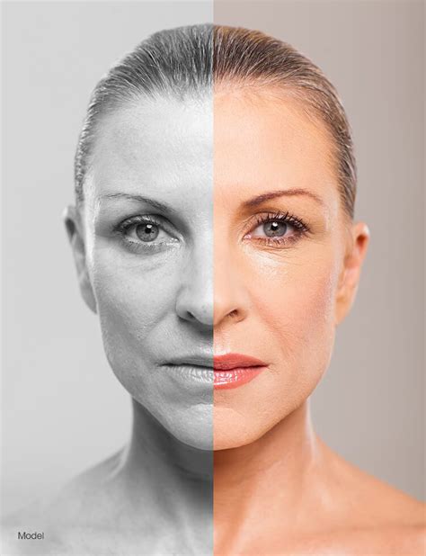 Is Facial Plastic Surgery Permanent? | North Shore Aesthetics