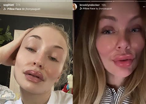 Ashley Benson, Sophie Turner and more call out plastic surgery trends ...