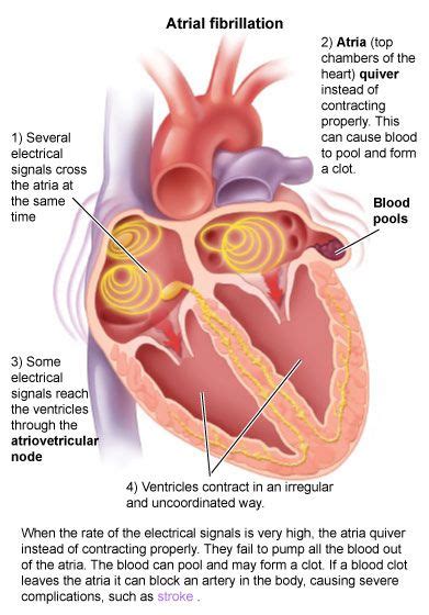 Pin on Med Surg