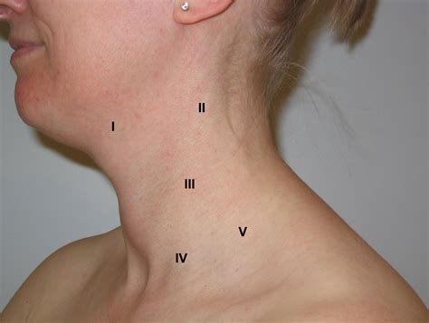 Anterior cervical lymph nodes - milobabes