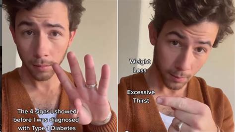 Nick Jonas shares 4 symptoms he experienced before getting diagnosed ...