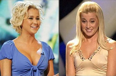 Celebrities Before and After Breast Implants ~ Travel Tans Pic